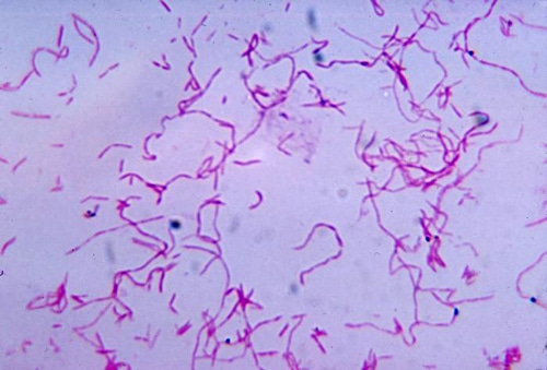 Yeni virus növü diş ətlərinin iltihabını sağaltmağa və xərçəngdən müdafiəyə kömək edəcək