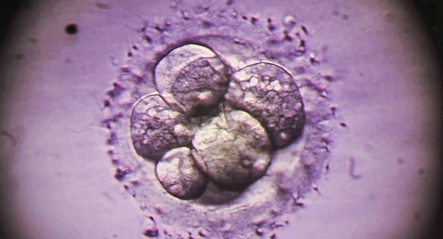 Alimlər embrion və xərçəngin inkişafının eyni molekulyar mexanizmlə bağlı olduğunu müəyyən ediblər