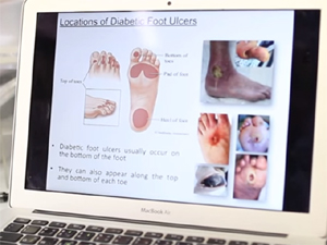 В Израиле изобрели «умные» носки для диабетиков