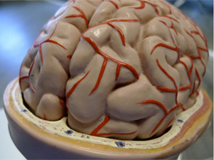 Scientists create soluble implants for brain surgery