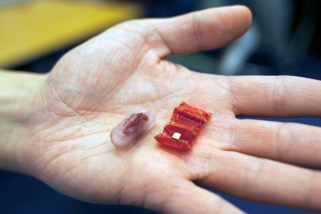 Ingestible Tiny Robots Can Now Save Your Life