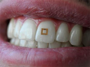 Simsiz diş sensoru qidanın kimyəvi tərkibini müəyyənləşdirəcək