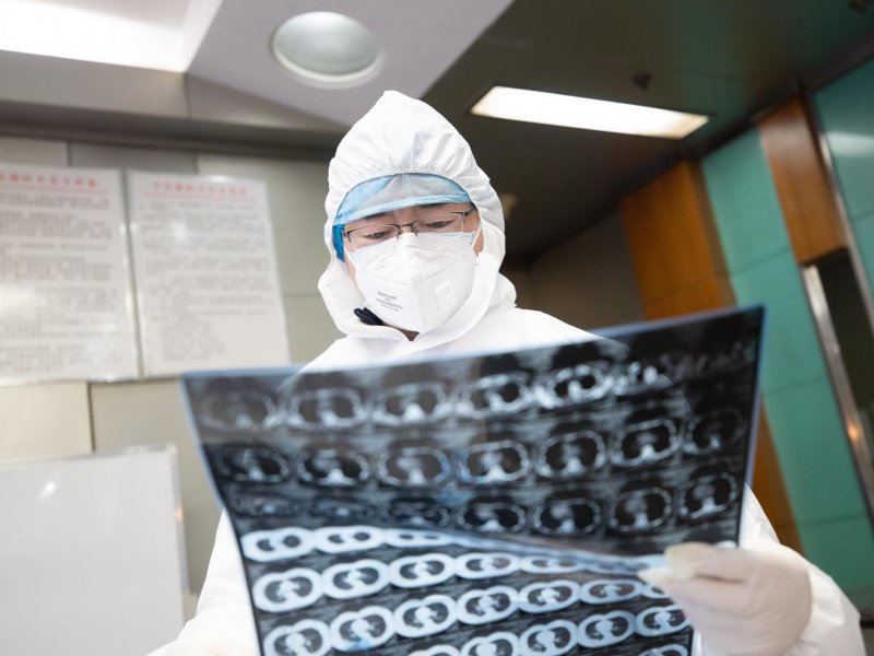 Yaponiyada koronavirusu bloklayan dərman tapılıb
