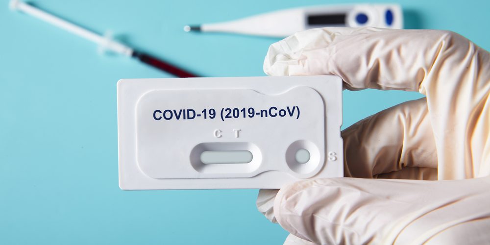 Russia has developed a new rapid test for antibodies to coronavirus