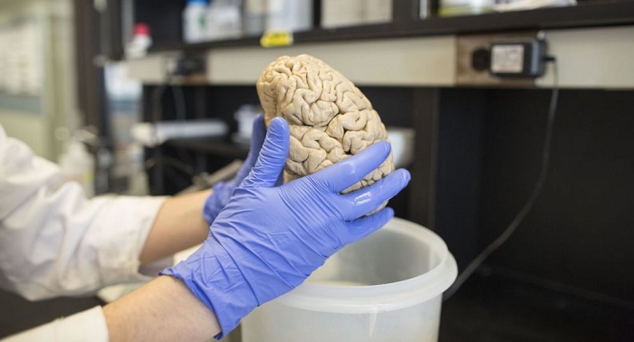 Bioçipin içində kiçik canlı beyin yetişdiriblər